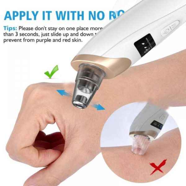 Electric Blackhead Suction Remover